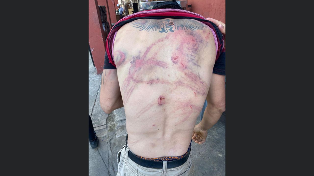 Albañil fue confundido con un antisocial y le dieron una brutal golpiza