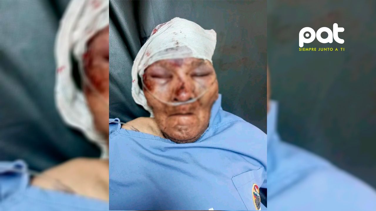Proyecto "Ayudemos al Prójimo" busca a familiares del señor Carlos Macedonio Condori
