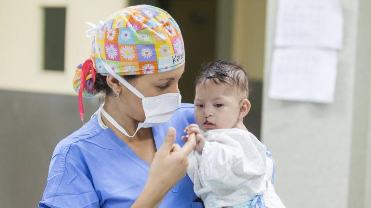 Campaña de cirugías gratuitas para niños con labio leporino