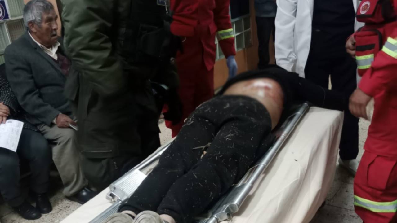 Adolescente herido  por arma de fuego en  la Curva del Diablo
