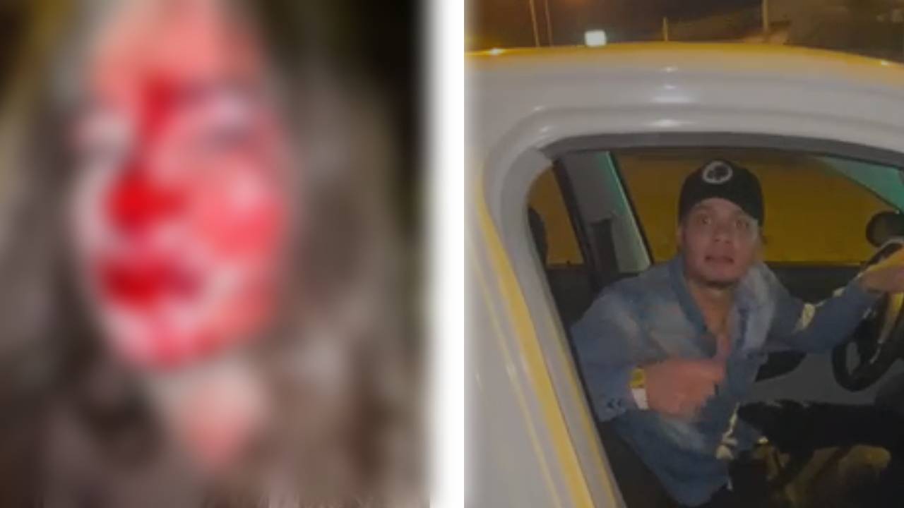 FELCV busca a agresor tras brutal golpiza a una mujer en Santa Cruz