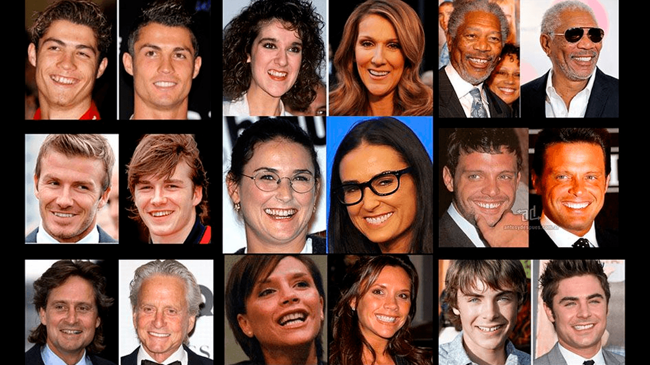 La obsesión global por los "Dientes Perfectos": ¿Realidad o Ficción?