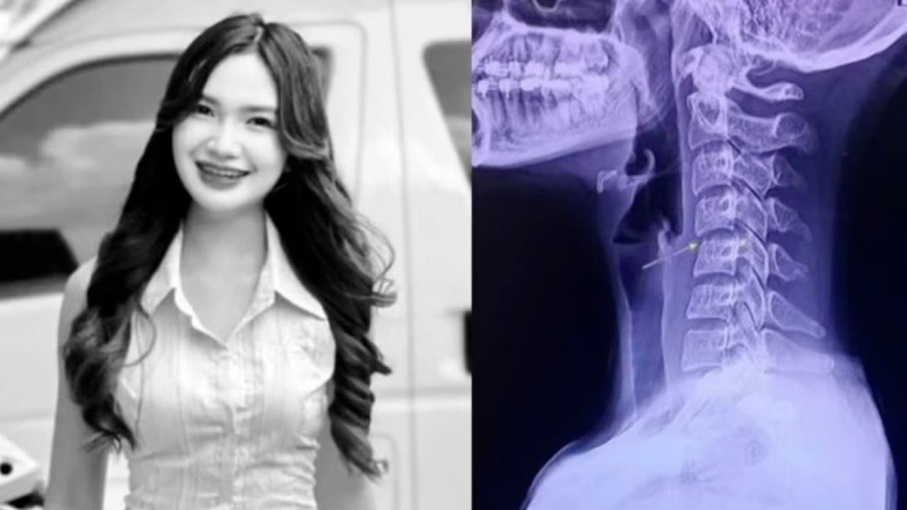 Cantante tailandesa falleció tras un masaje: los riesgos detrás de las torsiones cervicales