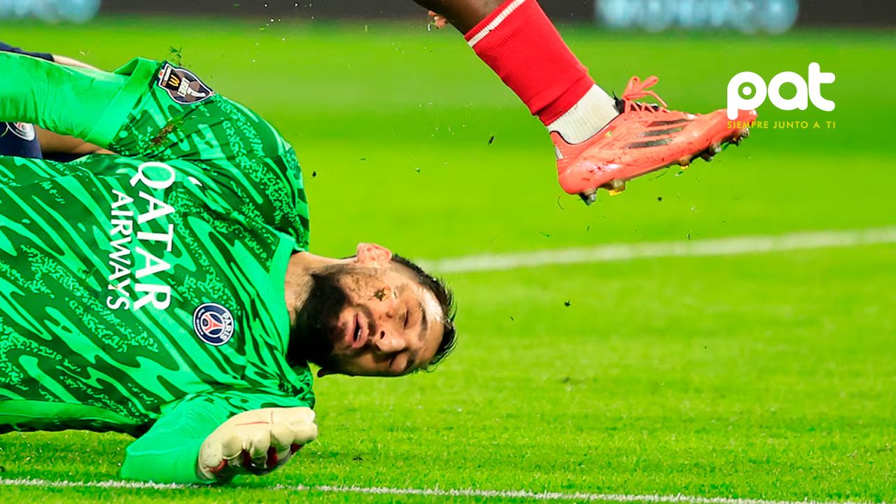Las impactantes imágenes de cómo quedó el rostro de Gianluigi tras recibir la brutal patada 
