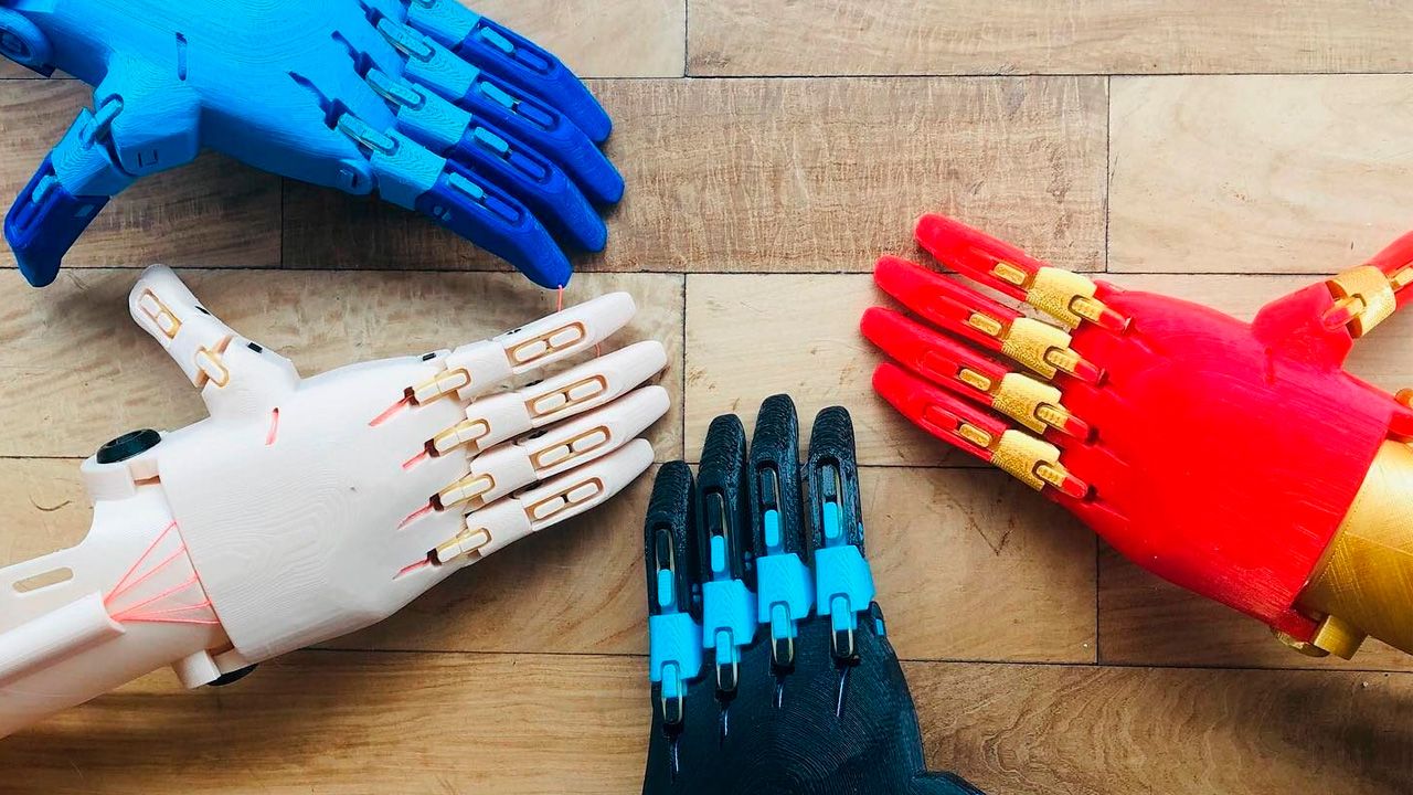 Prótesis impresas en 3D están cambiando la vida de decenas de amputados en Uruguay