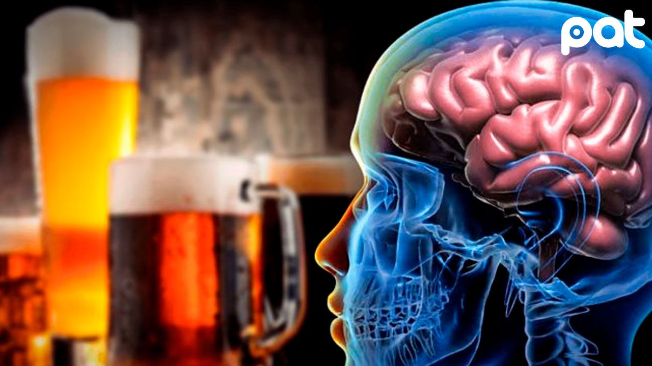 Nuevo estudio alerta sobre daño cerebral por consumo de alcohol