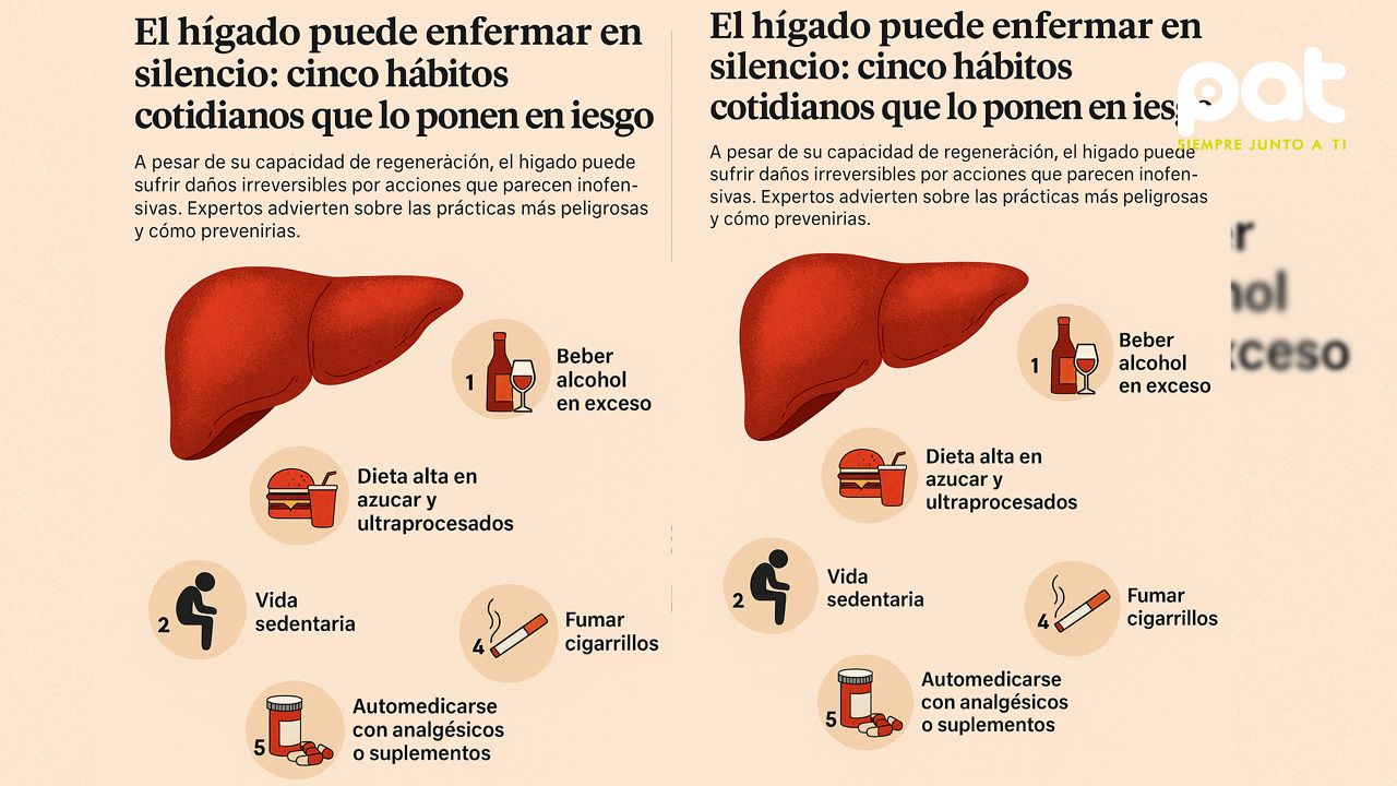El hígado puede enfermar en silencio: cinco hábitos cotidianos que lo ponen en riesgo