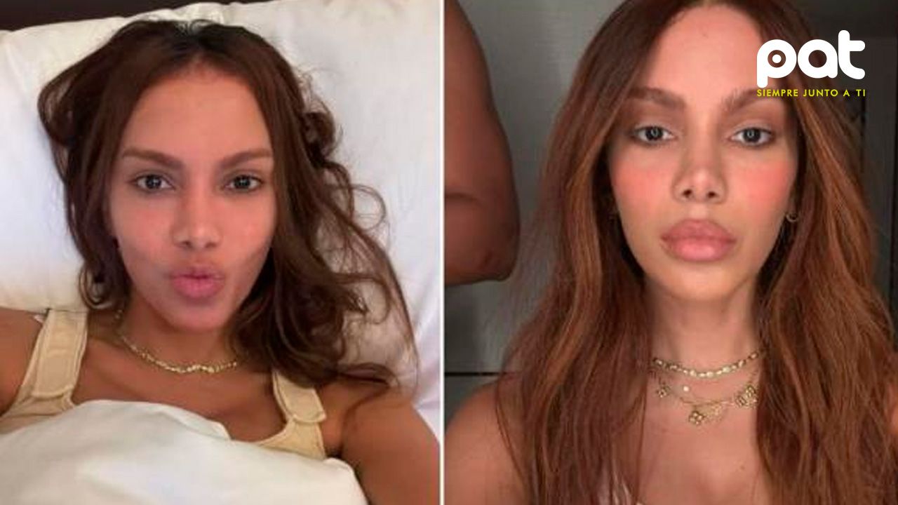 Anitta causa polémica por su nuevo rostro tras salir del hospital