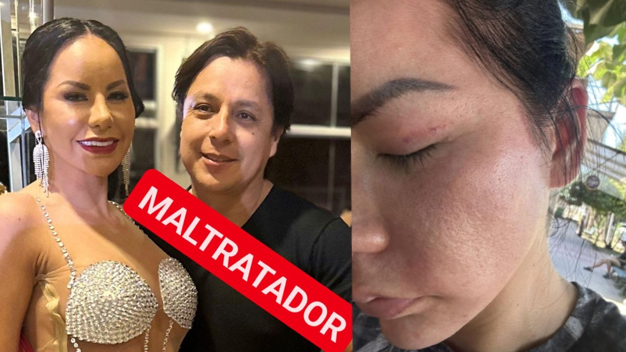 Mayte Flores denuncia agresiones físicas y psicológicas por parte de su pareja