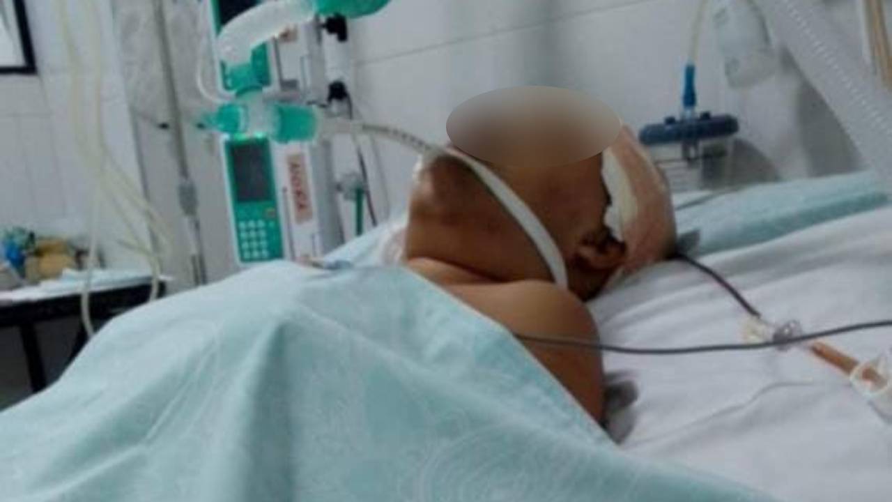 La mujer gravemente herida por accidente en un "torito" se encuentra en estado crítico