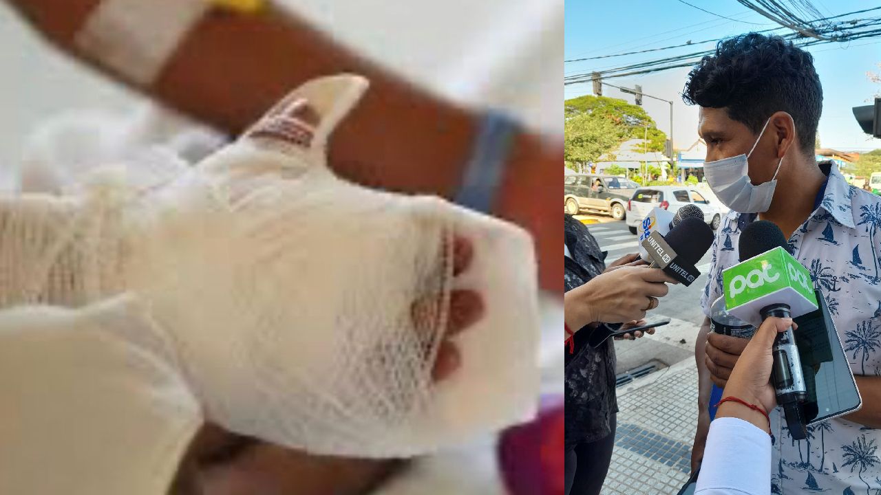 Menor quemado se somete a cirugía, familiares dejan su vida en manos de Dios 