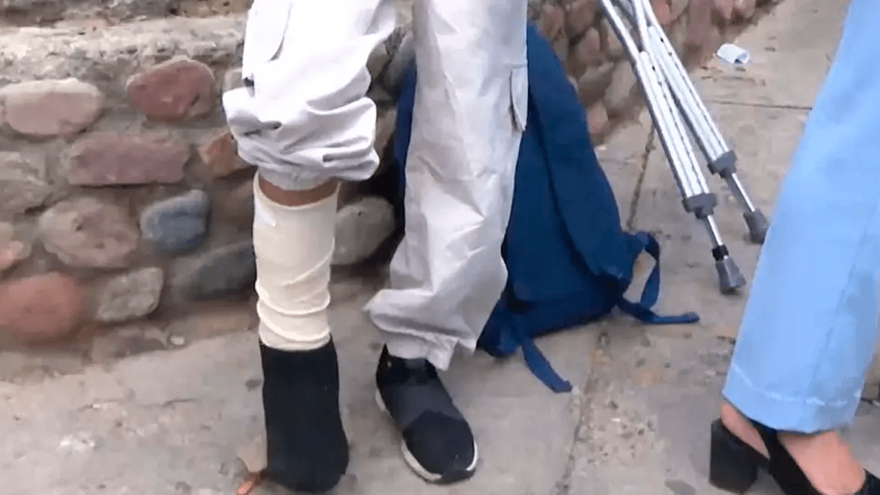 Niña de 10 años es arrollada y operada tras sufrir el robo de su celular en Cochabamba