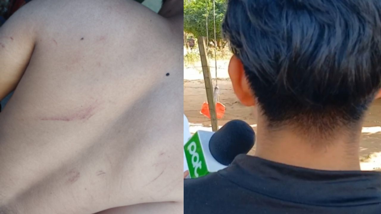 Joven de 17 años fue brutalmente golpeado por efectivos de la policía