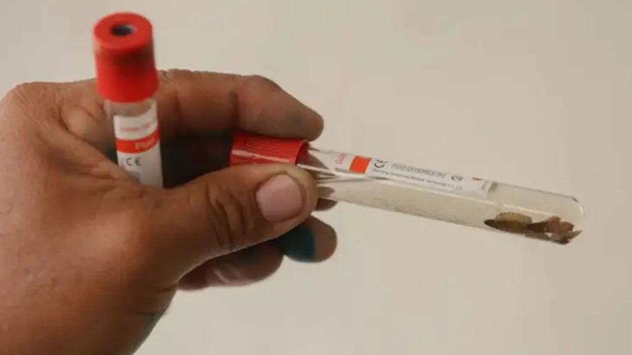 Suman 176 casos de gusano barrenador y tres muertes en Honduras