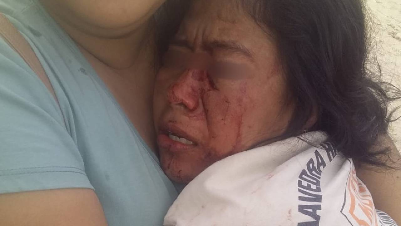 Violento ataque de expareja deja a una mujer gravemente herida en el barrio Urkupiña del Plan 3000