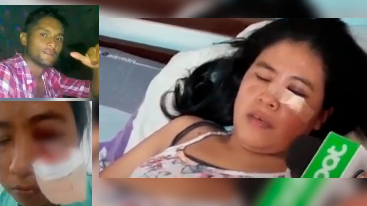 Mujer víctima narra agresiones de su expareja: "Decidí dejarlo por el bien de mi hijo"