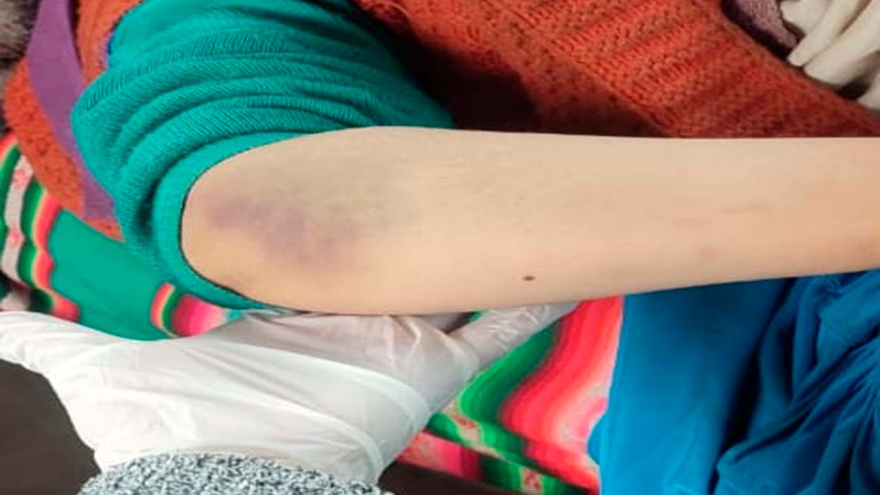 Trágico suceso en Oruro: Nueva víctima de feminicidio tras brutal agresión