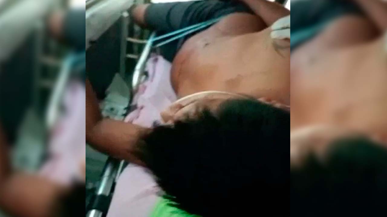 Incidente en Abapó: Ciudadano herido de bala por disparo de militar