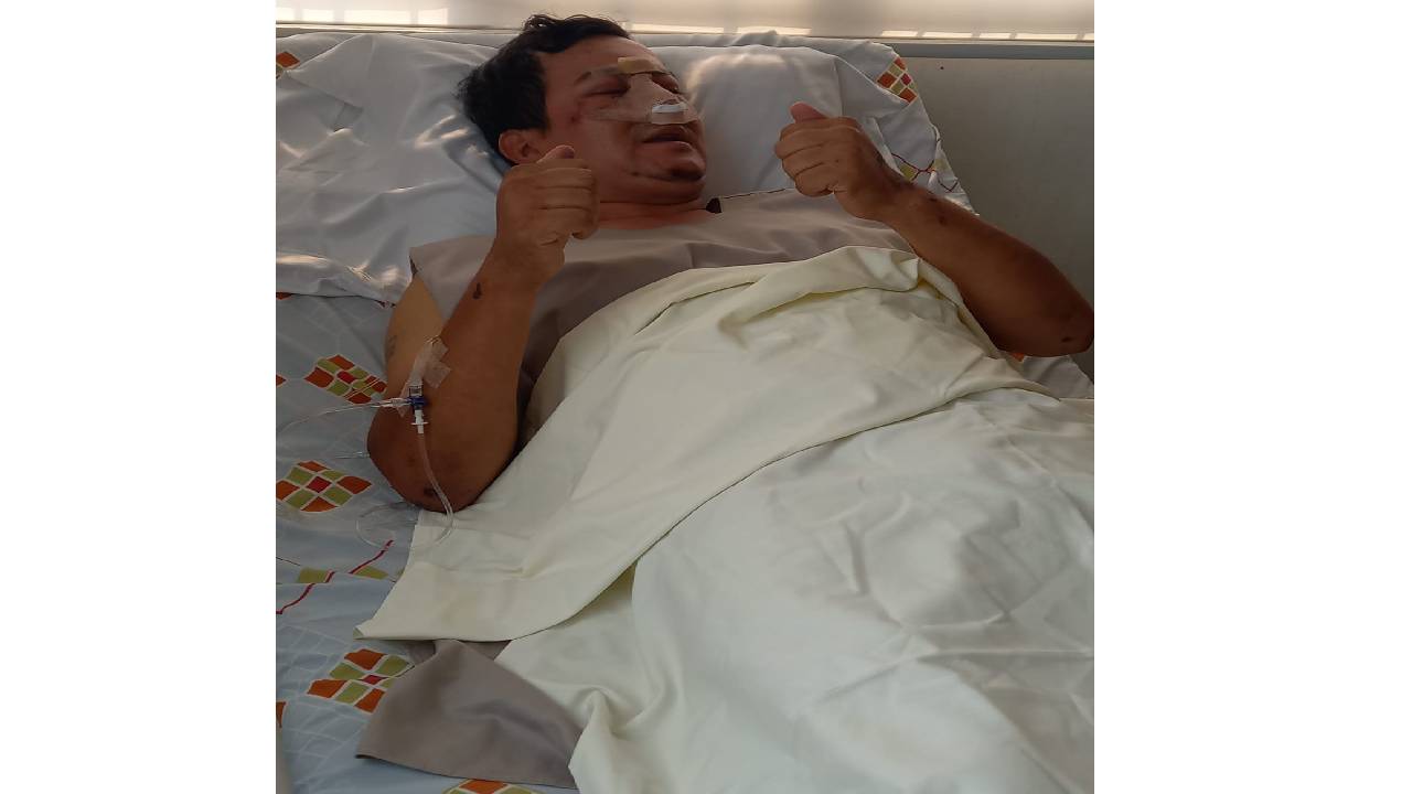  Policía Sufre Ataque Brutal de sus Compañeros
