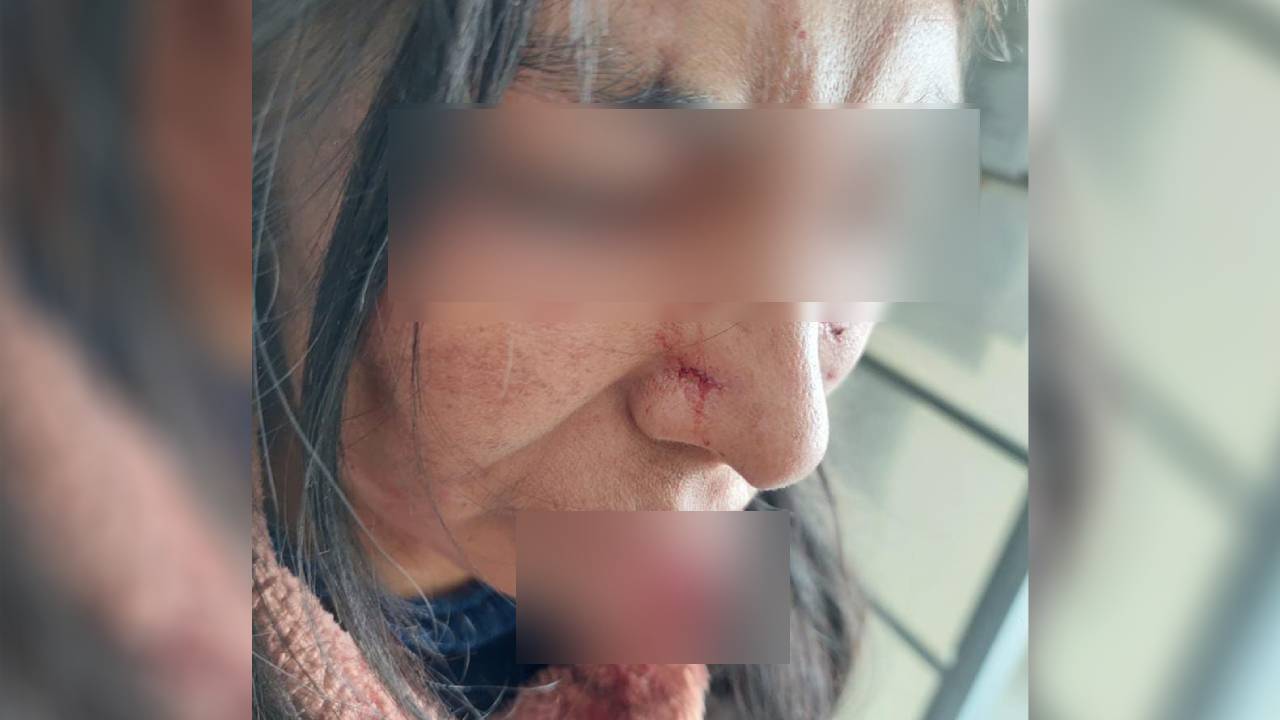 Ataque de celos en Oruro: Hombre violento deja a su pareja gravemente herida
